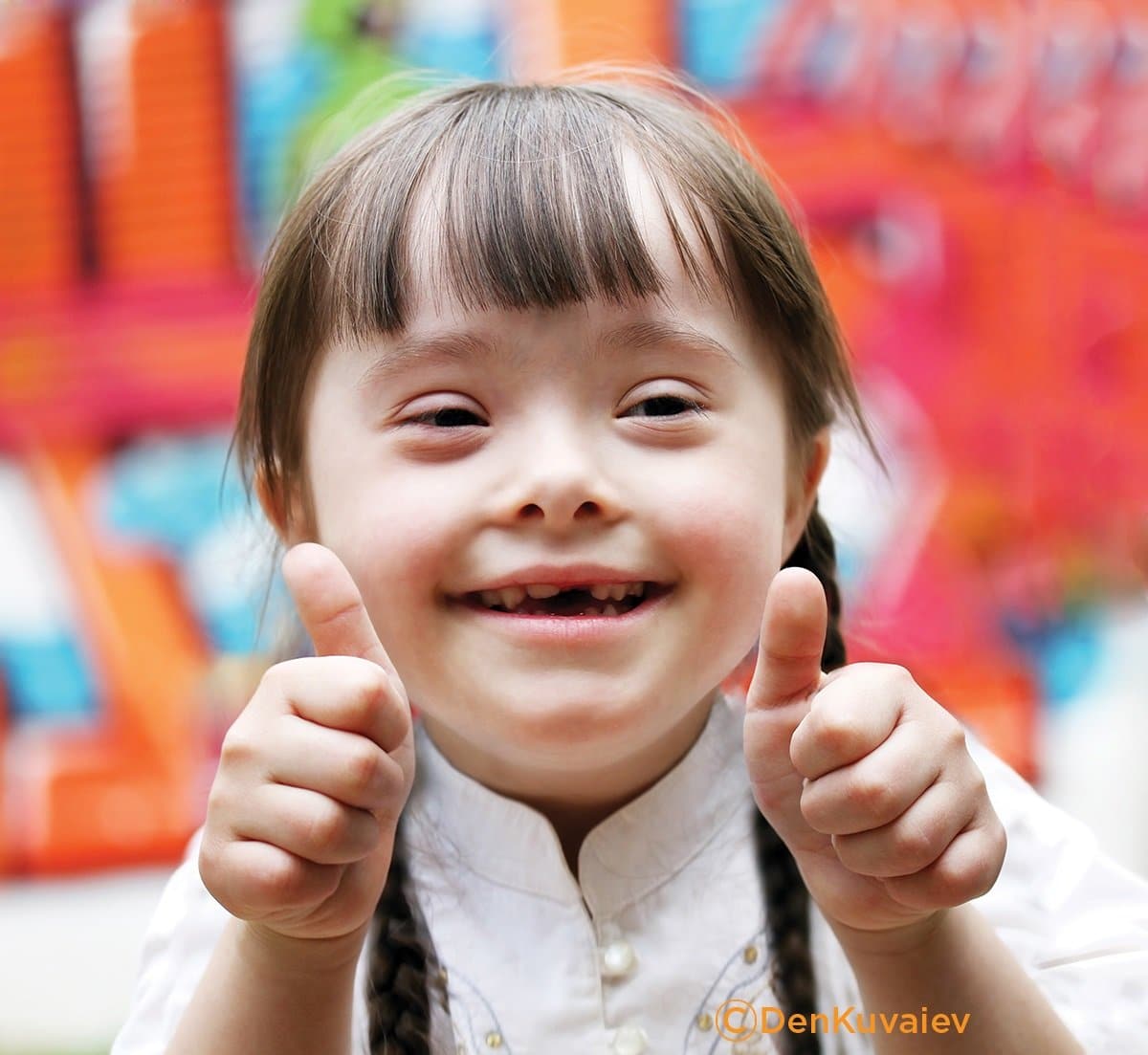 New Trans-NIH INCLUDE Project for Down Syndrome will provide up to $261M Over 5 Years