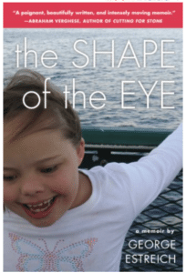 the shape of the eye