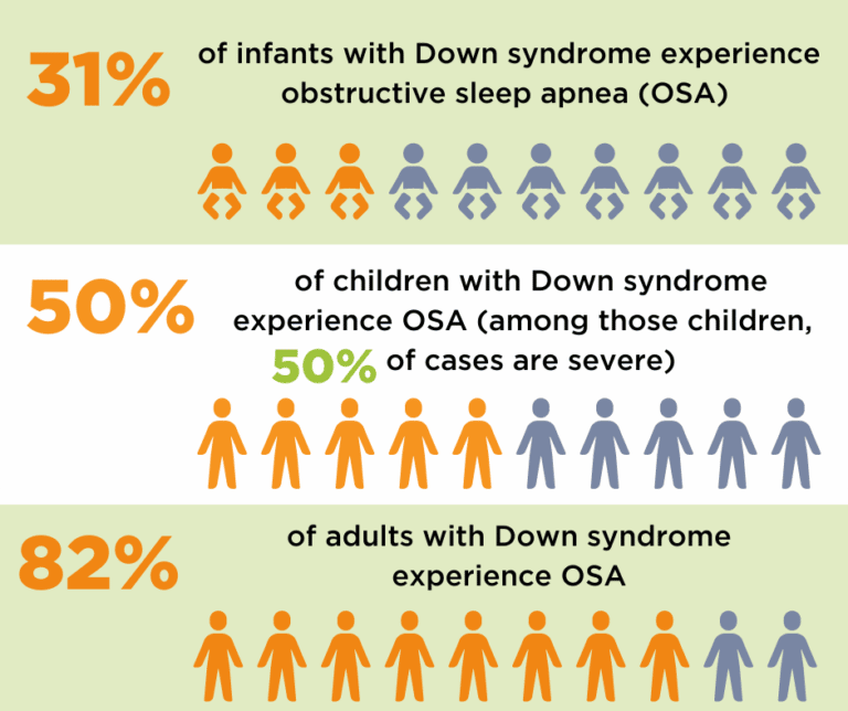 Why is Obstructive sleep apnea common in Down syndrome?